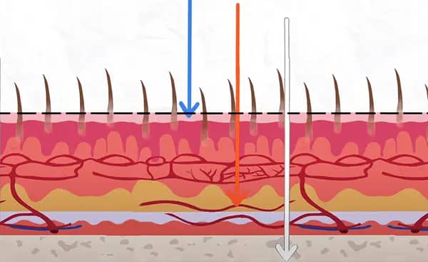 Different wavelengths of light have different penetrating power in human tissues